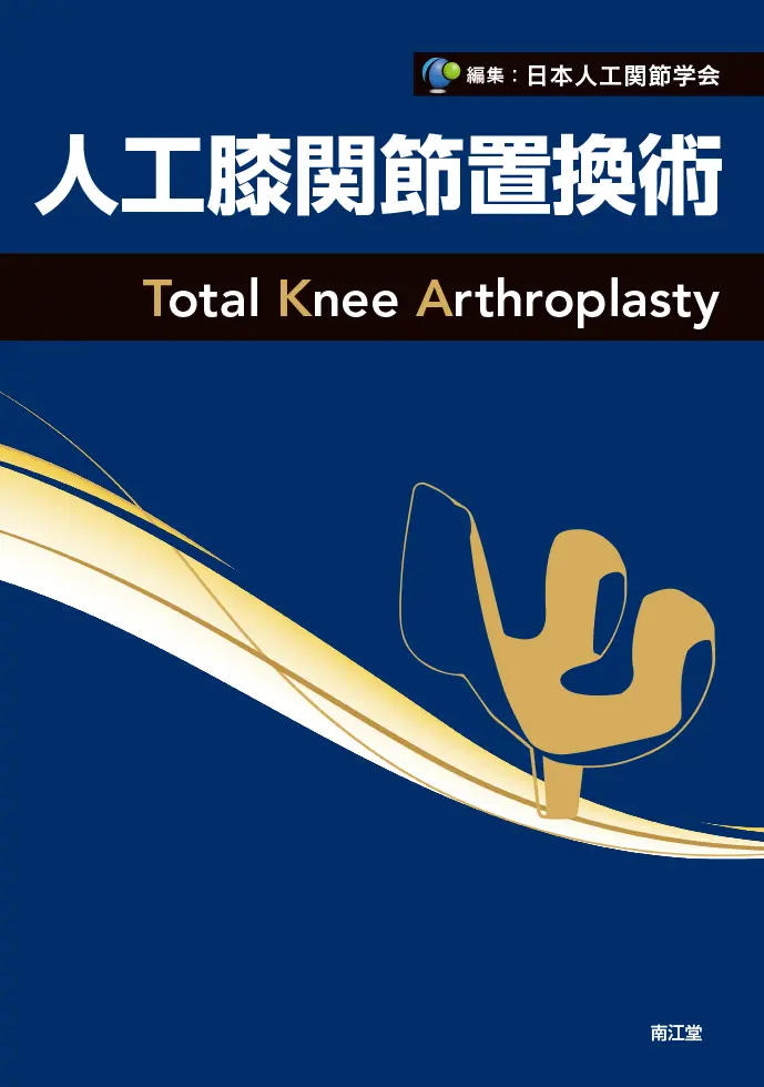 Total Knee Arthroplasty